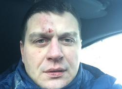 Тюменец получил телесные повреждения во время общения с инспекторами ГИБДД