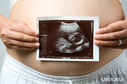Клипарт Депозитфото, узи, беременная, живот беременной, беременная женщина, пособие по беременности, Декрет