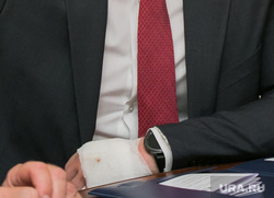 Председатель Курганской областной Думы Дмитрий Фролов с травмированной рукой. Курган, фролов дмитрий, забинтованная рука