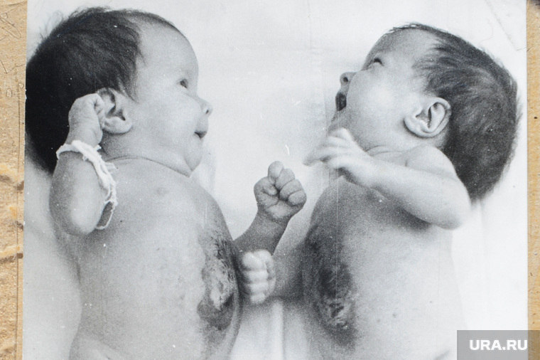Сиамские близнецы необр, фото из семейного альбома