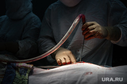 Операция на позвоночнике в Сургутской клинической травматологической больнице. Сургут, операция, медицина, руки хирурга