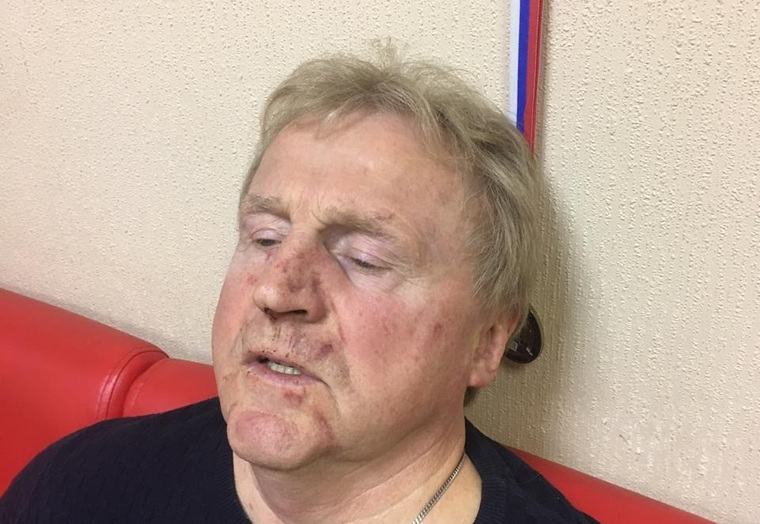 Олег Строгонов после драки с бывшим тестем попал в больницу