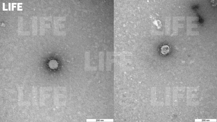 Изображение коронавируса под микроскопом