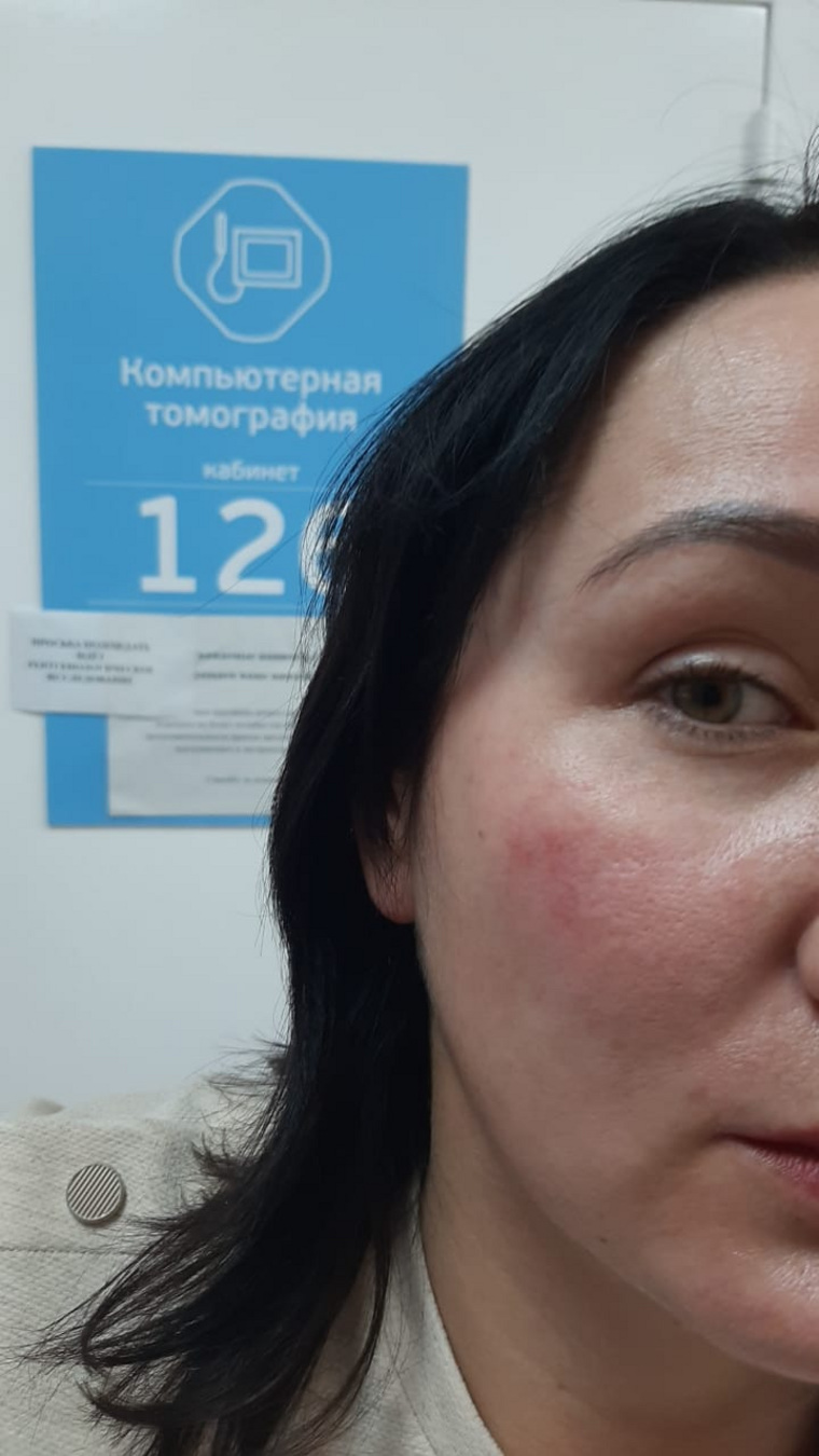 Депутат гордумы Асбеста Наталья Крылова зафиксировала побои в больнице