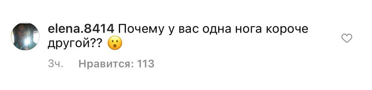 Поклонники звезды обратили внимание на длину ног