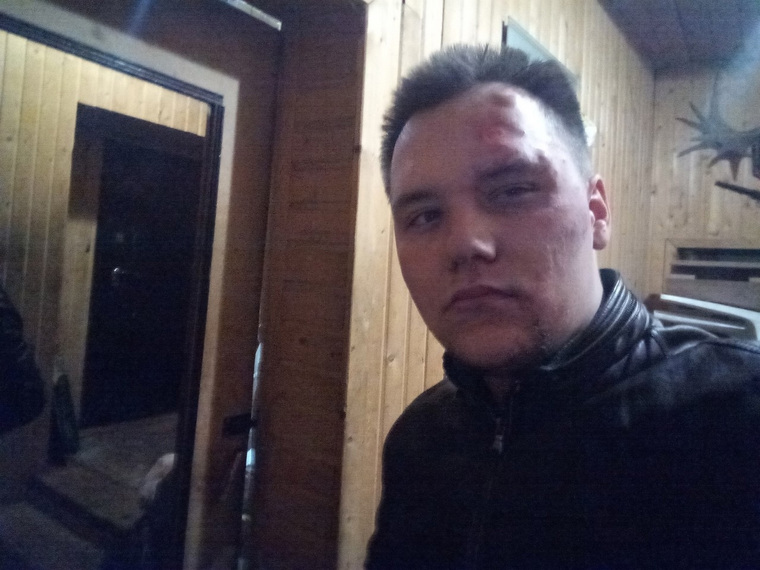 Пермяк решил постричься в барбершопе мигрантов, но оказался избит