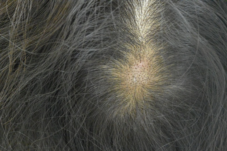 Последствия перетирания волос