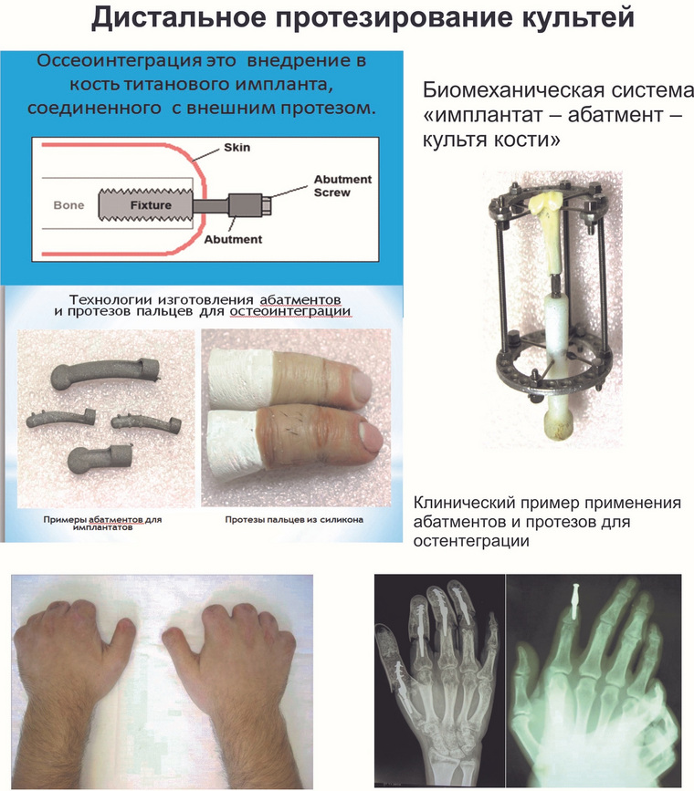 Научный проект курганских врачей включен в число прорывных проектов Уральского НОЦ