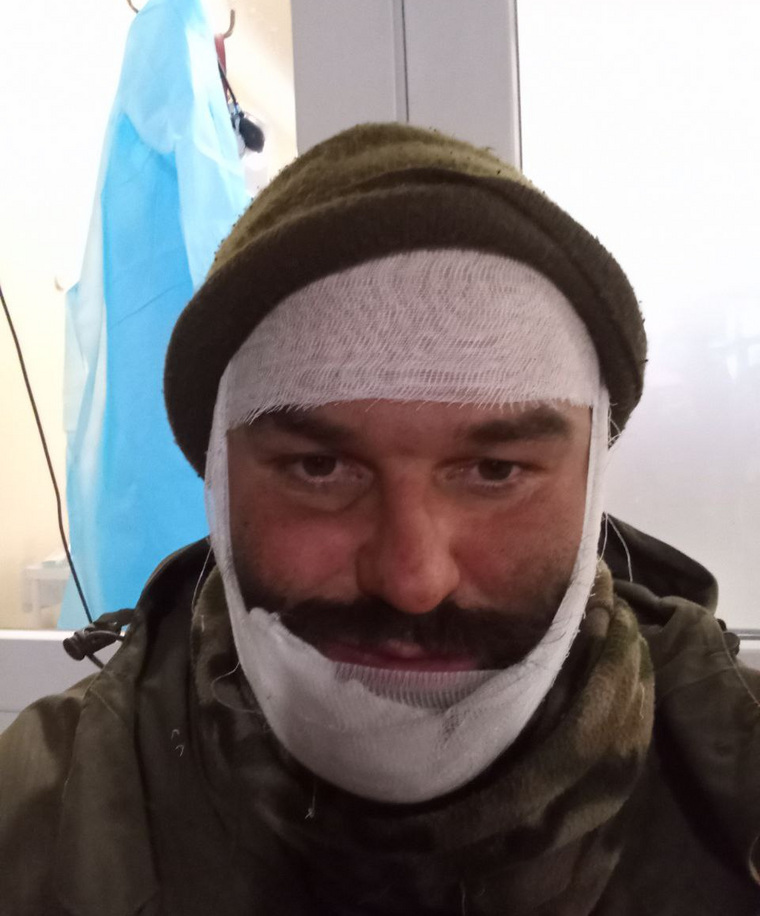 Александр Григоренко получил на передовой осколочное ранение в челюсть
