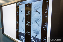 Презентация нового роботизированного операционного микроскопа в ГКБ № 40. Екатеринбург, рентгеновский снимок, больница, сосуды, врачи, аневризма