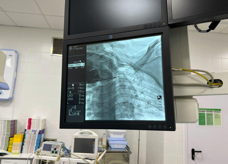 Новый ангиограф появился в отделении рентгенохирургических методов диагностики и лечения больницы Салехарда
