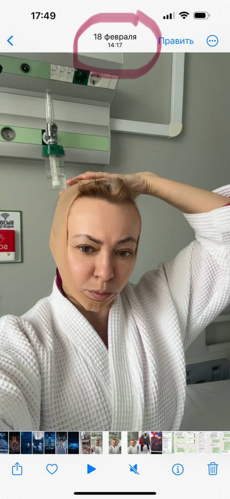 Фото Рудковской после операции 