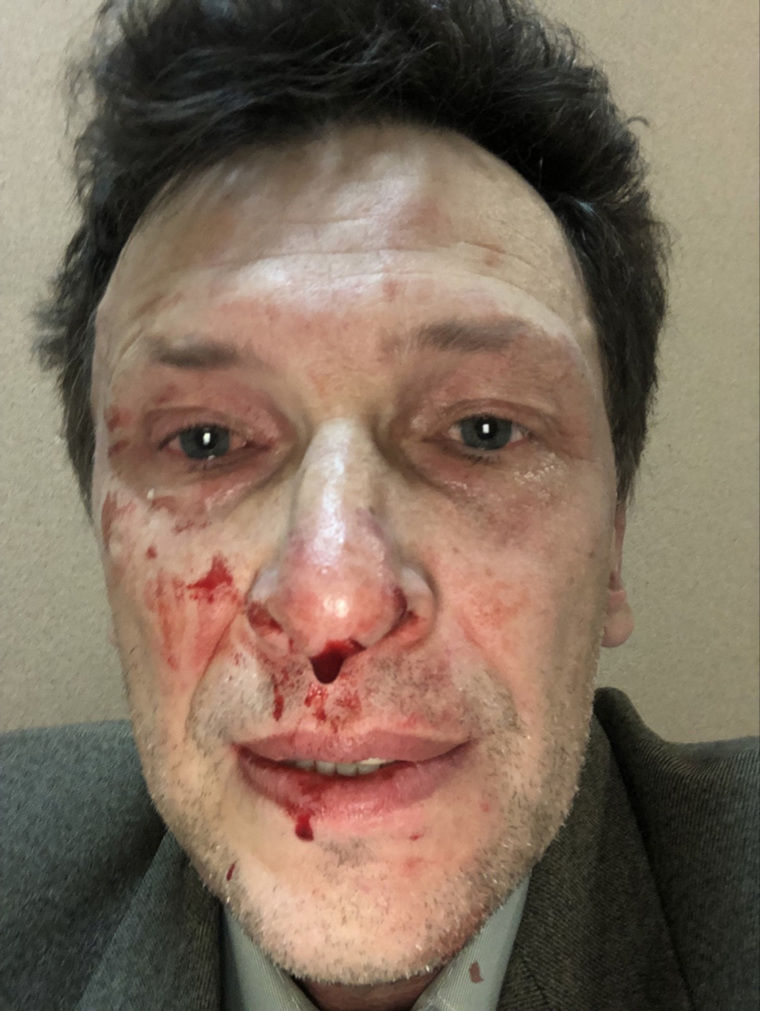 Романа Юшкова, получившего травмы, доставили в больницу на скорой помощи