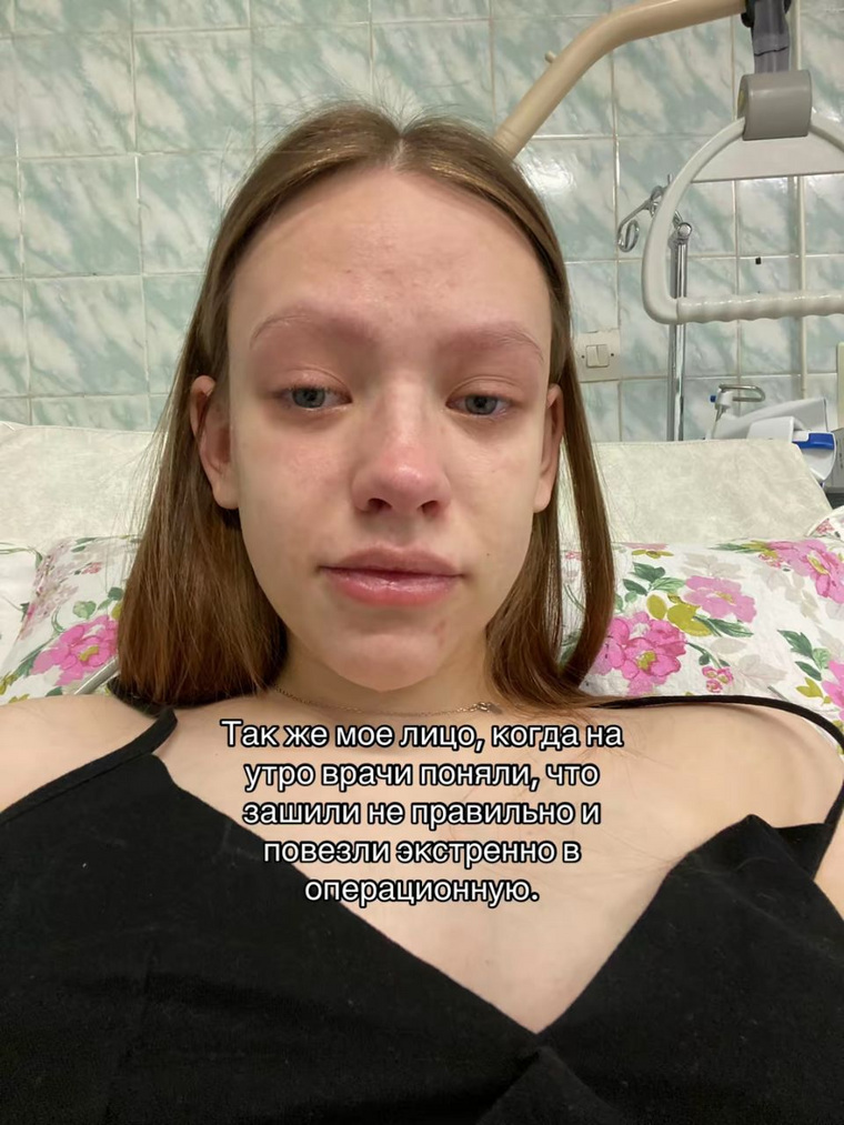 Зашили Дарью якобы неправильно