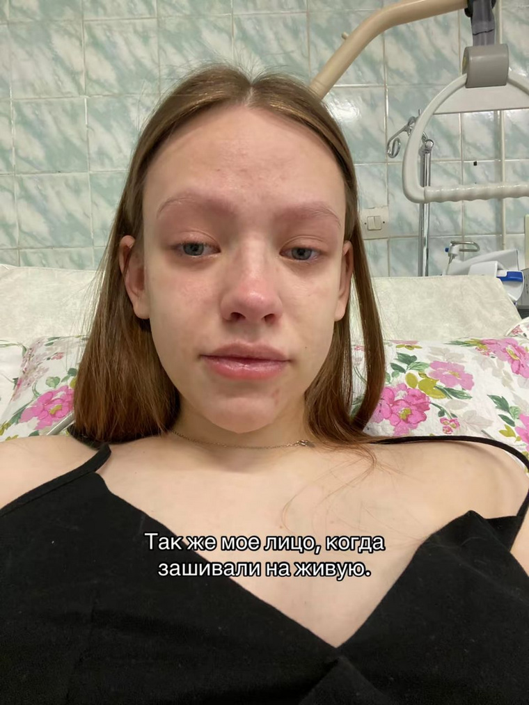 Девушка заявляет, что после операции ее якобы зашивали наживую
