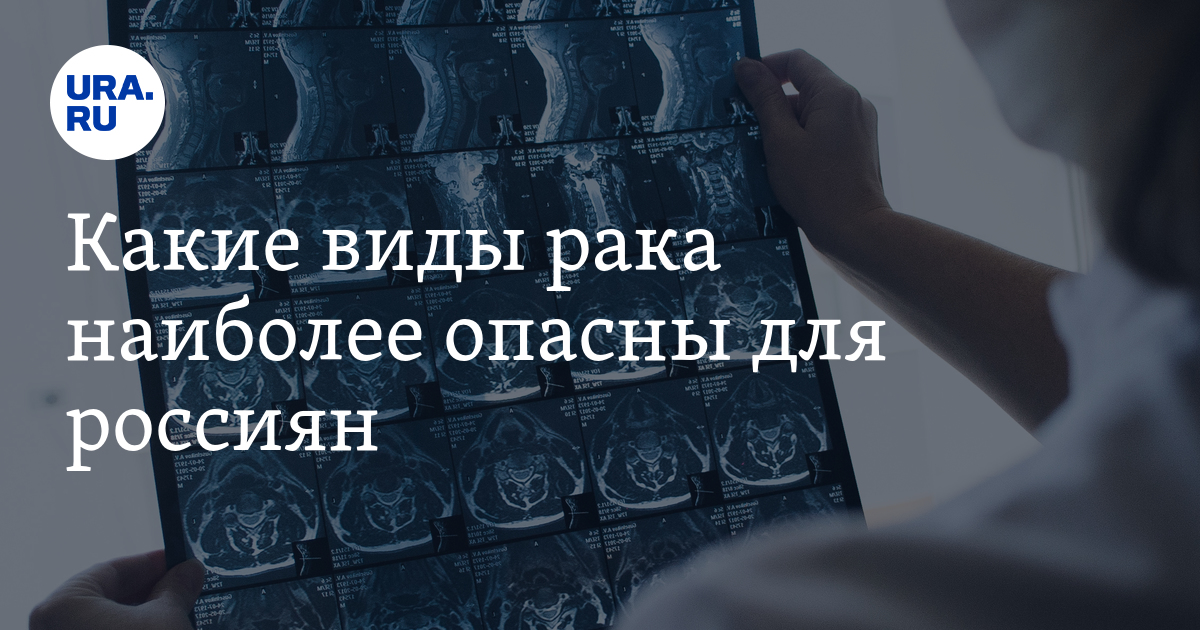 Статистика онкологических заболеваний. Самая опасная онкология. Какой самый неизлечимый рак. Какой самый неизлечимый рак. Самые распространенные онкологические заболевания.