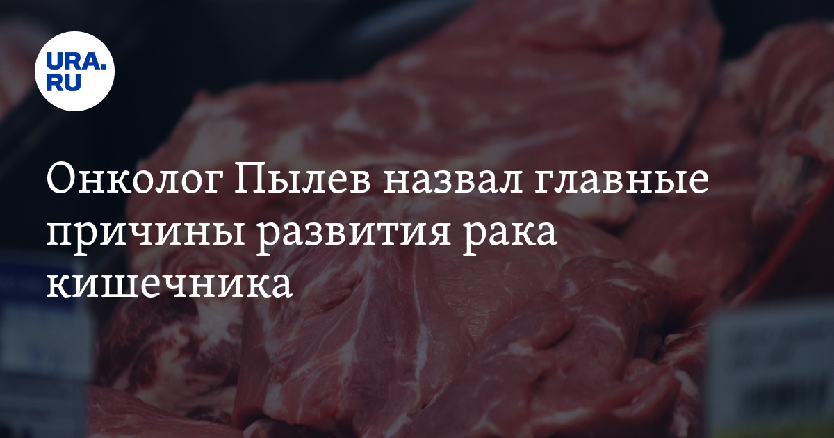 Онкология: рак кишечника, причины, советы врача