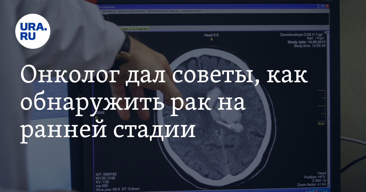 Советы онколога. Мозг поражение коронавирусом. Короно вирус действия на головной мозг. Как коронавирус влияет на работу мозга. Короноирус породил ТИКТОК головного мозга.