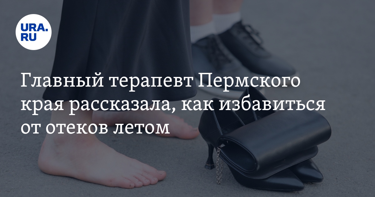 Как избавиться от отеков летом в жару. Избавься от отеков к летнему сезону. отказался от обуви.