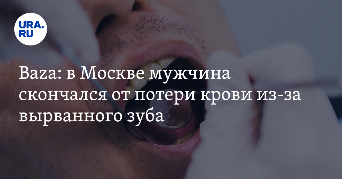 В Москве мужчина скончался от потери крови из-за вырванного зуба